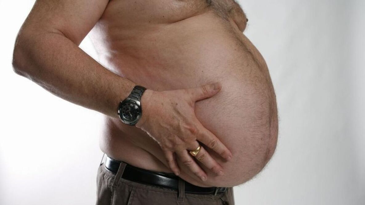 varis gelişiminin bir nedeni olarak obezite